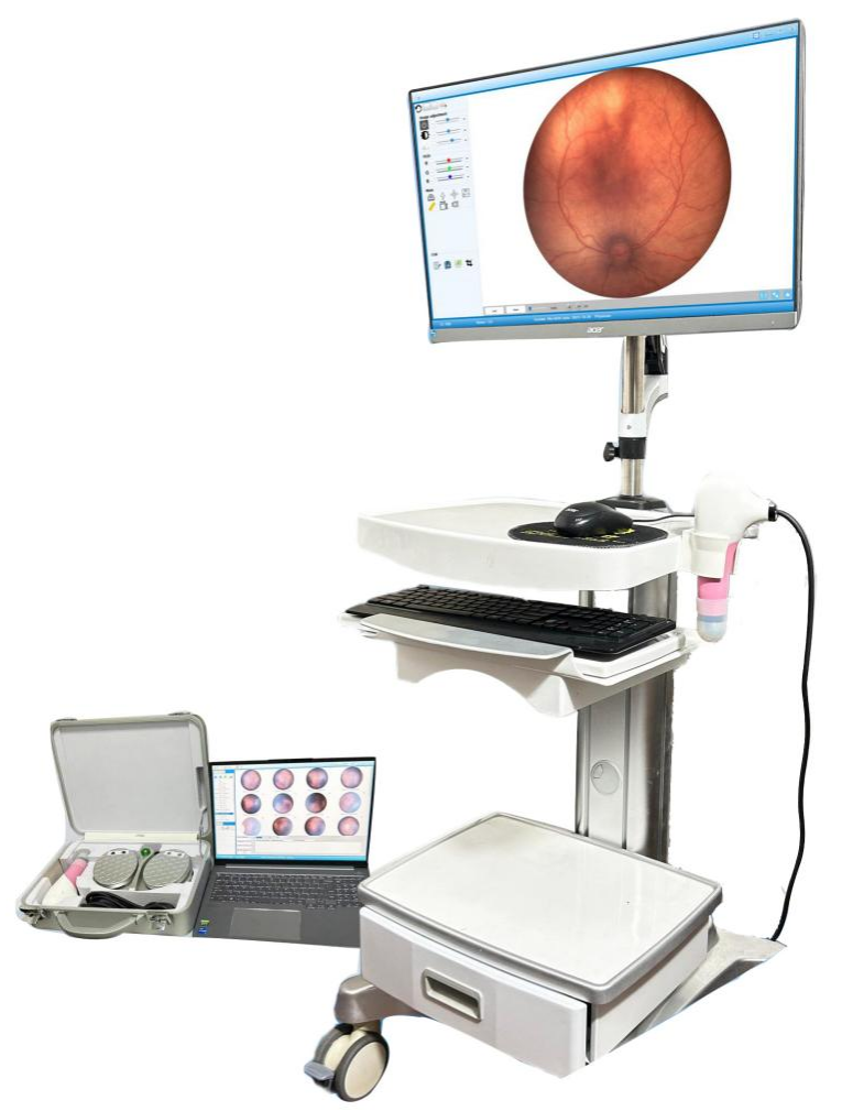 Caméra de fond d’œil pédiatrique grand champ WFF-8000